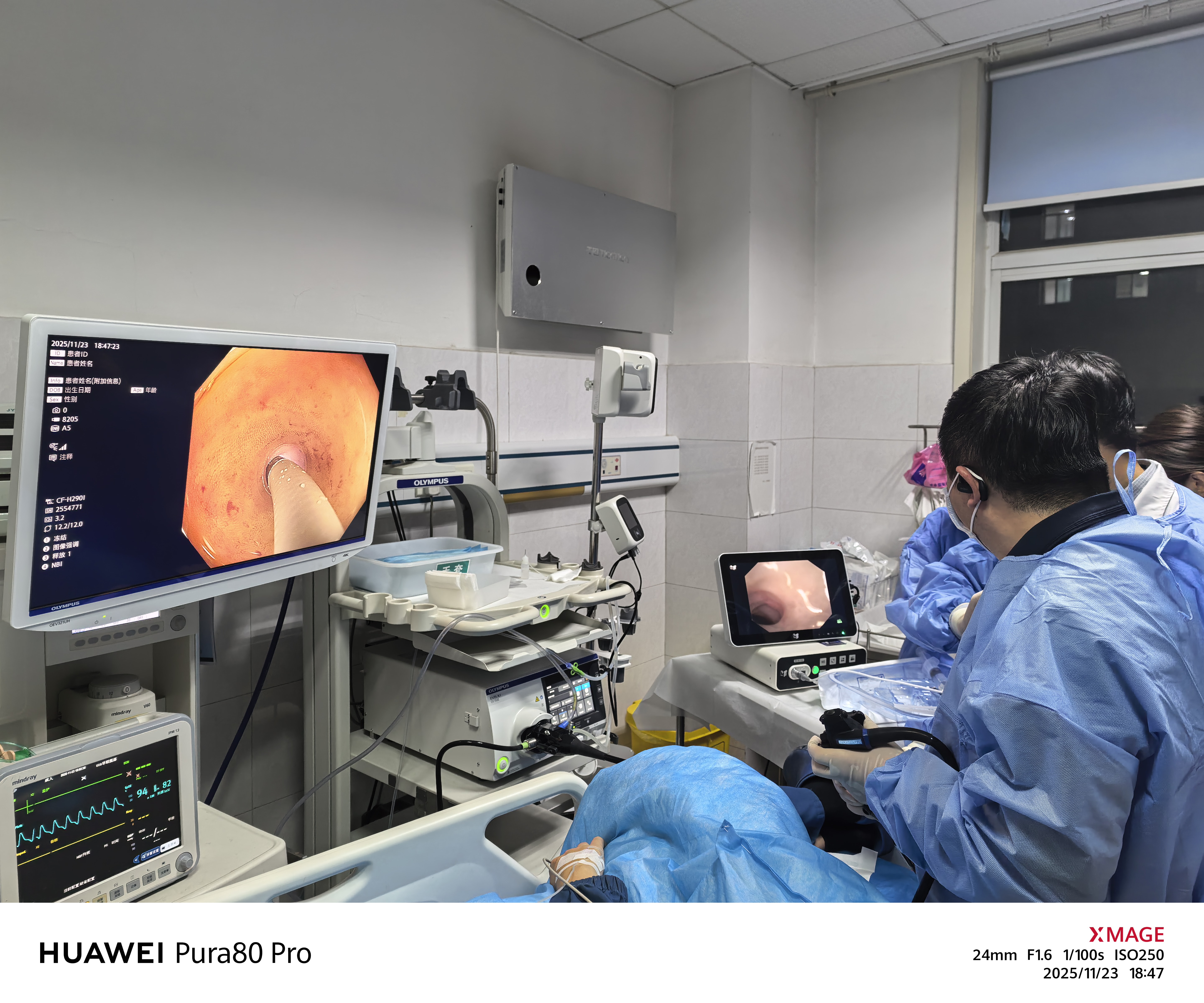 微创“立竿见影”——我院胃肠外科成功开展ERAT新技术，为阑尾炎患者提供新选择