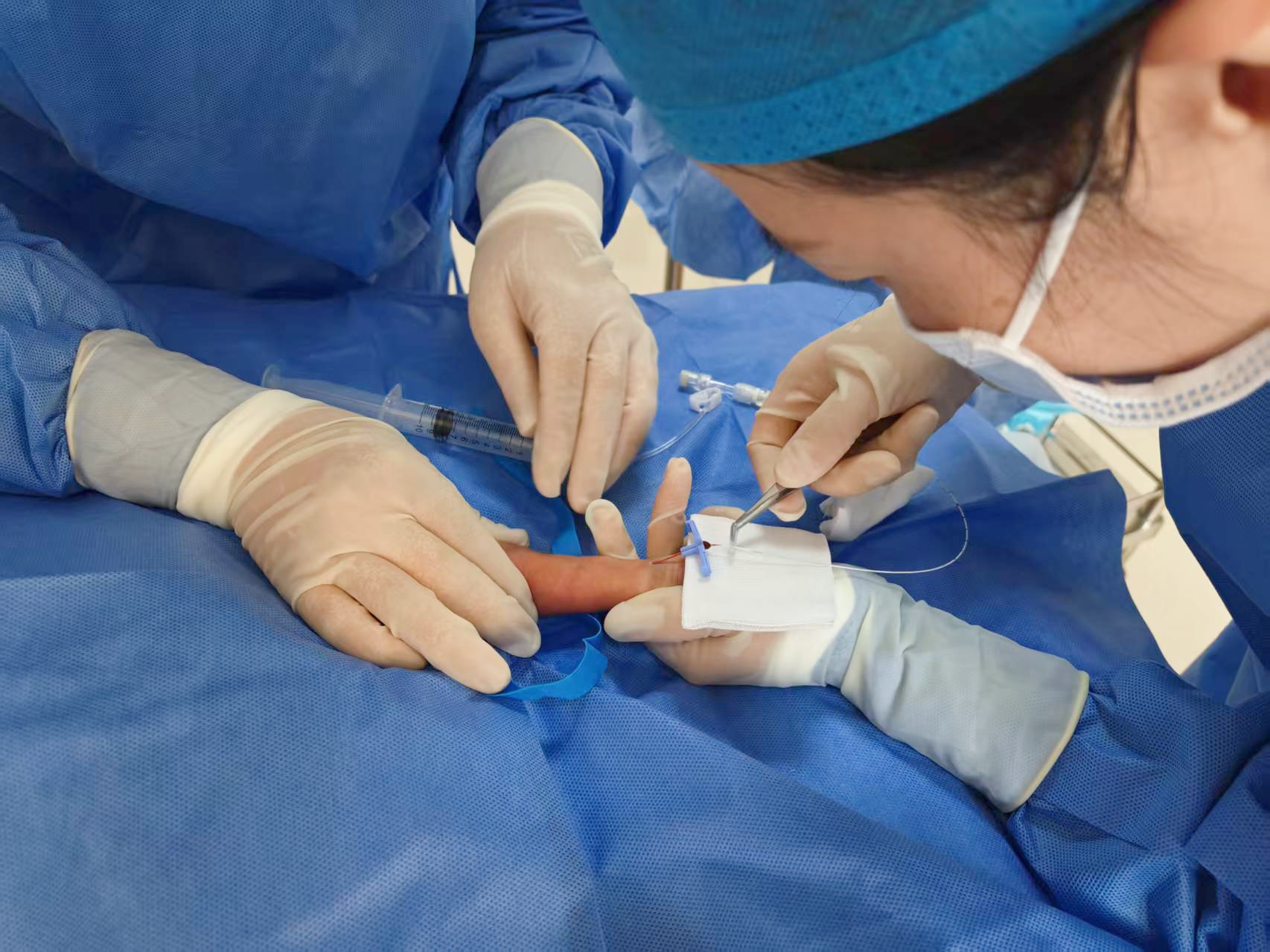 专业技术护佑微萌生命——我院新生儿科成功为四例极低体重早产儿实施PICC置管